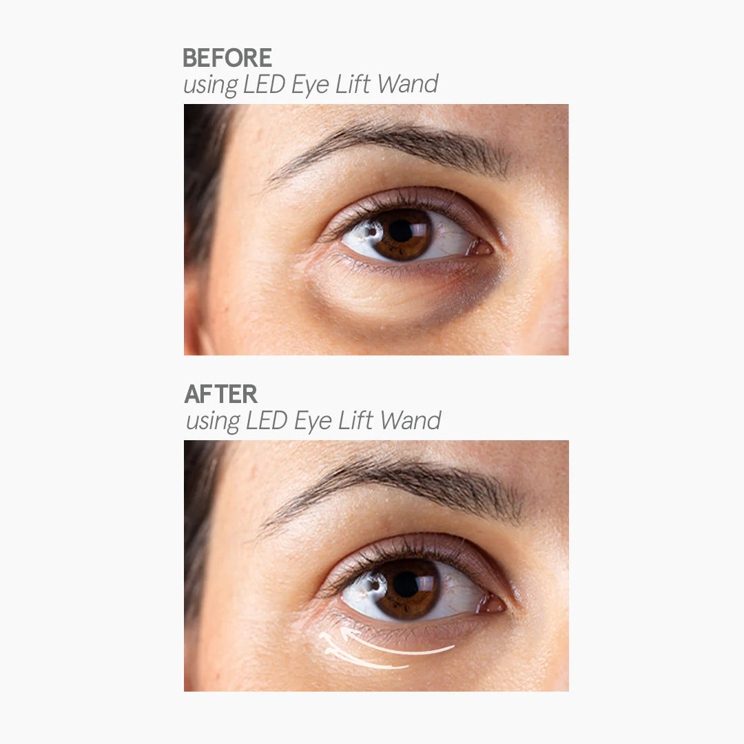 Love K-Derma LED Eye Lift Wand With Eye cream included